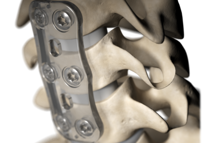 INION S-1™
